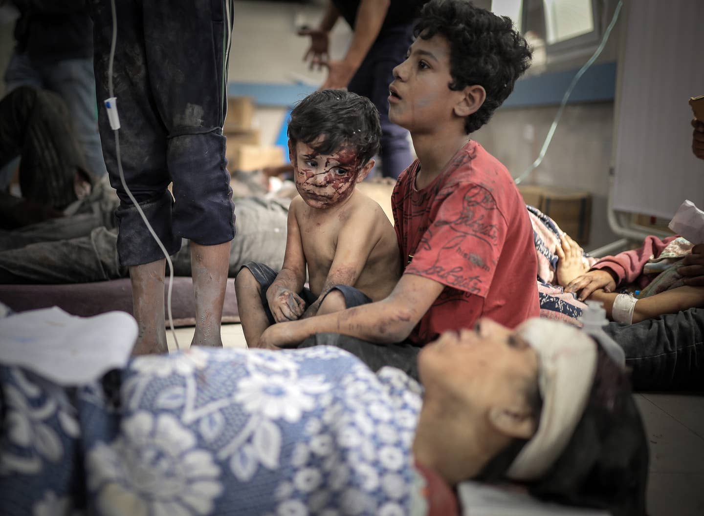 People injured after Israeli attacks, are taken to Al-Shifa Hospital as Israeli attacks continue on 17th day of clashes in Gaza City, Gaza on October 23, 2023. (Photo by Belal Khaled/Anadolu via Getty Images)